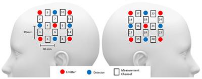 Empirical comparison of deep learning models for fNIRS pain decoding